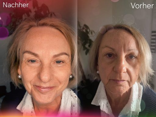 Zwei Porträts einer Person: links nachher, rechts vorher, beide mit natürlichem Licht.